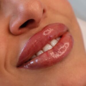 {"ARInfo":{"IsUseAR":false},"Version":"1.0.0","MakeupInfo":{"IsUseMakeup":false},"FaceliftInfo":{"IsChangeEyeLift":false,"IsChangeFacelift":false,"IsChangePostureLift":false,"IsChangeNose":false,"IsChangeFaceChin":false,"IsChangeMouth":false,"IsChangeThinFace":false},"BeautyInfo":{"SwitchMedicatedAcne":false,"IsAIBeauty":false,"IsBrightEyes":false,"IsSharpen":false,"IsOldBeauty":false,"IsReduceBlackEyes":false},"HandlerInfo":{"AppName":2},"FilterInfo":{"IsUseFilter":false}}